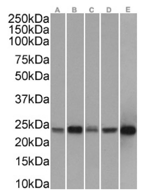 PRDX2 Antibody in Western Blot (WB)