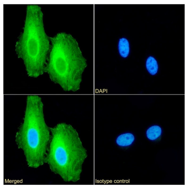 Apolipoprotein J Antibody in Immunocytochemistry (ICC/IF)