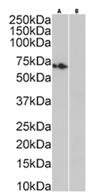 Rhodopsin Antibody in Western Blot (WB)