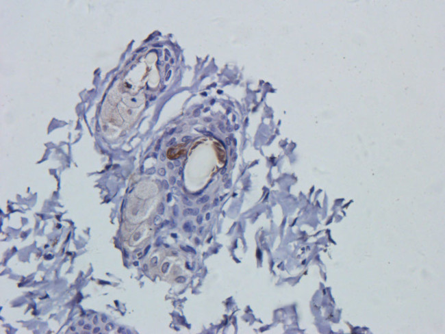 VEGF Antibody in Immunohistochemistry (Paraffin) (IHC (P))