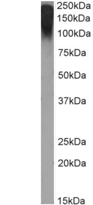 MUC1 Chimeric Antibody in Western Blot (WB)