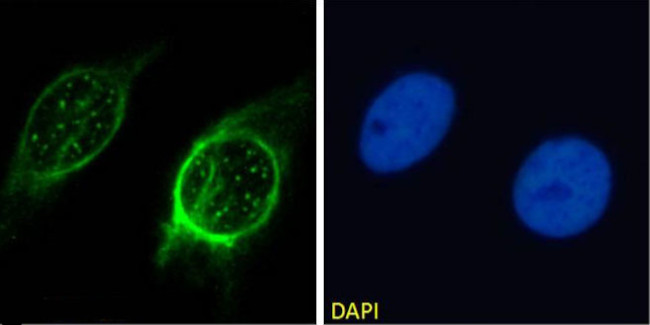 MMP14 Antibody in Immunocytochemistry (ICC/IF)