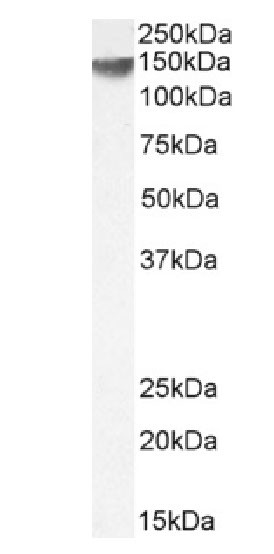 ErbB2 (HER-2) Antibody in Western Blot (WB)