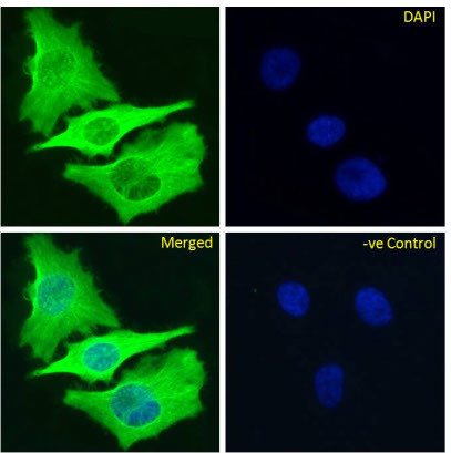 beta Tubulin Chimeric Antibody in Immunocytochemistry (ICC/IF)