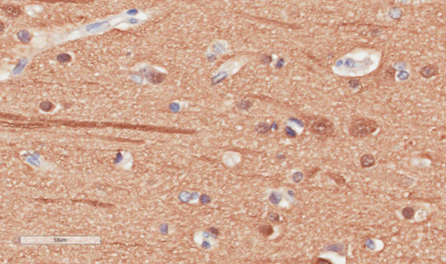 beta Tubulin Chimeric Antibody in Immunohistochemistry (Paraffin) (IHC (P))