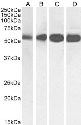 beta Tubulin Chimeric Antibody in Western Blot (WB)