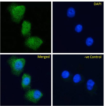 GIPR Chimeric Antibody in Immunocytochemistry (ICC/IF)