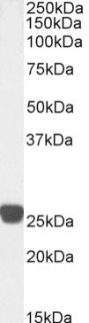 Cardiac Troponin I Chimeric Antibody in Western Blot (WB)