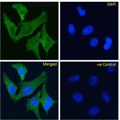 TrkA Chimeric Antibody in Immunocytochemistry (ICC/IF)