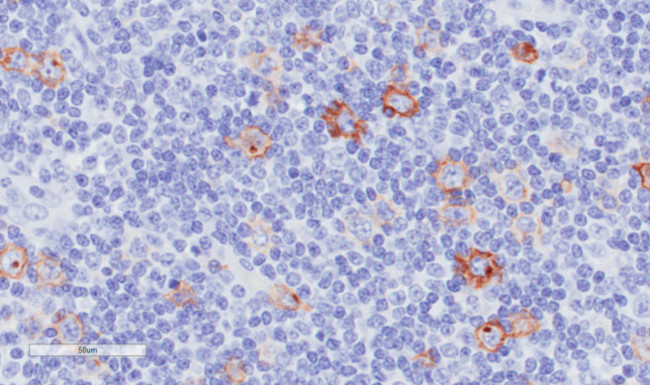 CD30 Chimeric Antibody in Immunohistochemistry (Paraffin) (IHC (P))