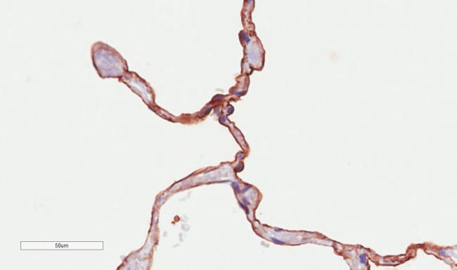 CD55 Chimeric Antibody in Immunohistochemistry (Paraffin) (IHC (P))