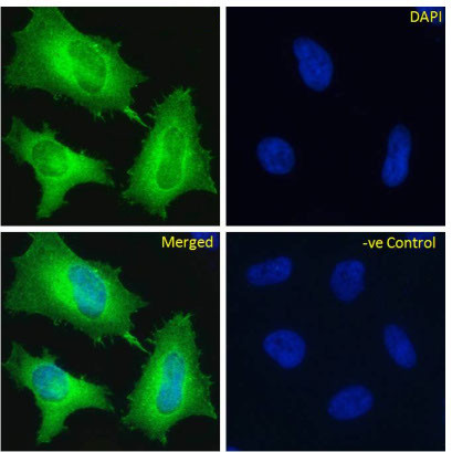 EDB-FN Chimeric Antibody in Immunocytochemistry (ICC/IF)