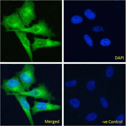 EDB-FN Chimeric Antibody in Immunocytochemistry (ICC/IF)