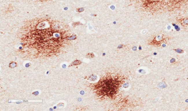 beta Amyloid Chimeric Antibody in Immunohistochemistry (Paraffin) (IHC (P))