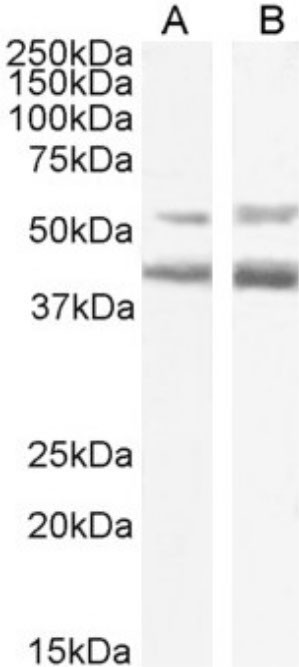 Mogamulizumab Chimeric Antibody in Western Blot (WB)