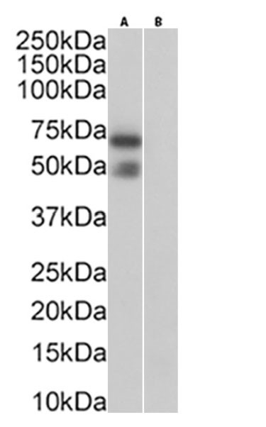 Podoplanin Chimeric Antibody in Western Blot (WB)