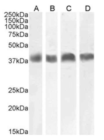 Podoplanin Chimeric Antibody in Western Blot (WB)