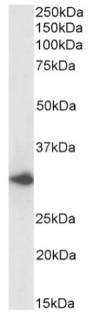 DARC Chimeric Antibody in Western Blot (WB)