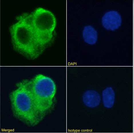 TRAIL-R2 (DR5) Chimeric Antibody in Immunocytochemistry (ICC/IF)