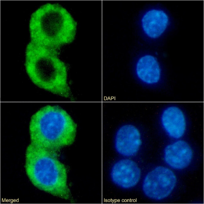 CMKLR1 Chimeric Antibody in Immunocytochemistry (ICC/IF)