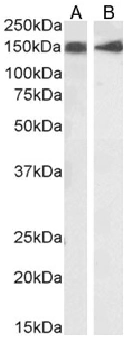 CD56 (NCAM) Antibody in Western Blot (WB)