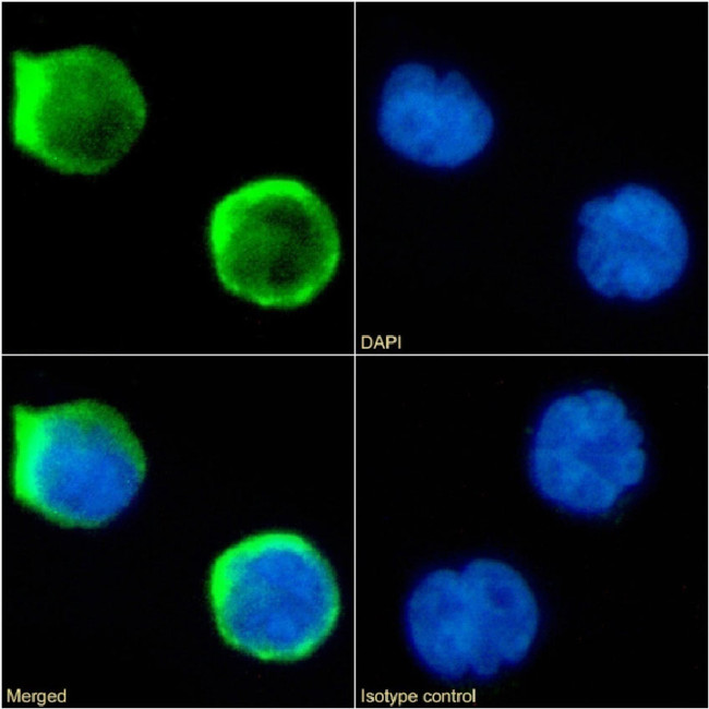 CD1a Chimeric Antibody in Immunocytochemistry (ICC/IF)