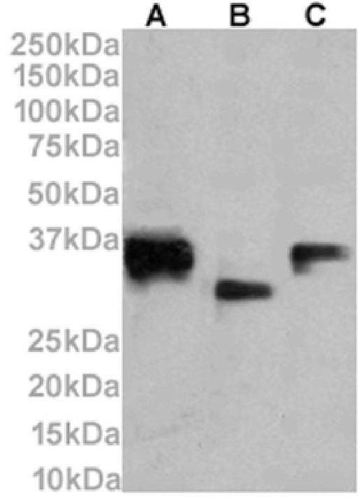 CD74 Chimeric Antibody in Western Blot (WB)