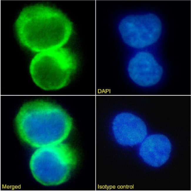 CCR5 Chimeric Antibody in Immunocytochemistry (ICC/IF)