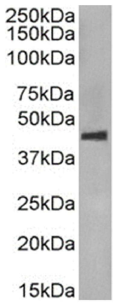 Phospho-CCR5 (Ser349) Chimeric Antibody in Western Blot (WB)