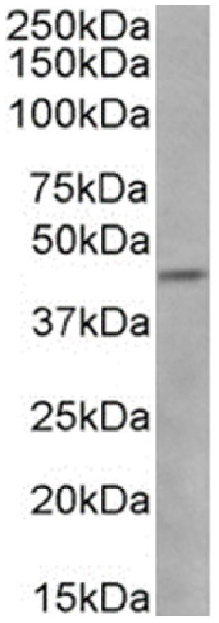 Phospho-CCR5 (Ser337) Chimeric Antibody in Western Blot (WB)