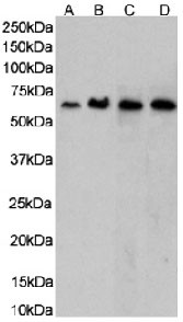 CCR5 Chimeric Antibody in Western Blot (WB)