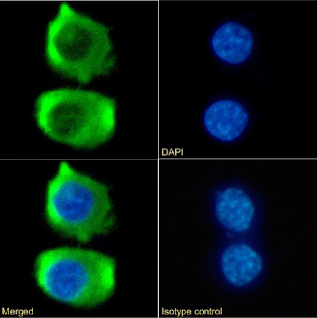 CCR9 Chimeric Antibody in Immunocytochemistry (ICC/IF)