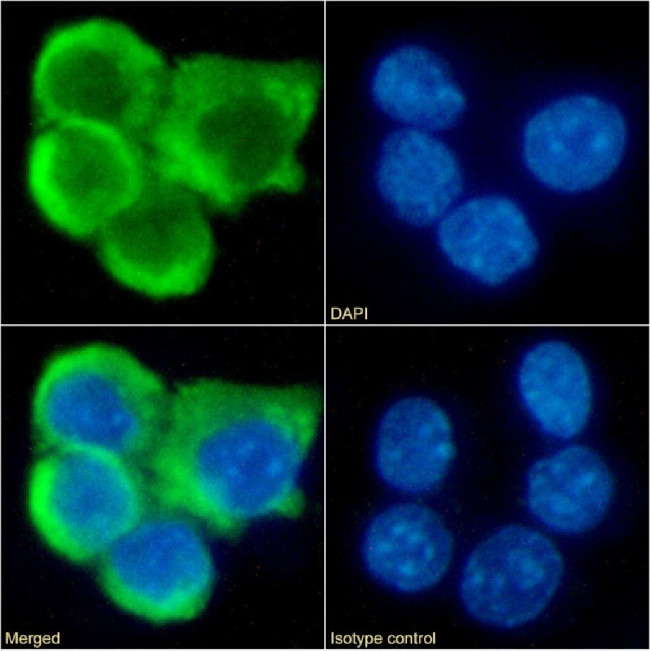 CCR7 Chimeric Antibody in Immunocytochemistry (ICC/IF)