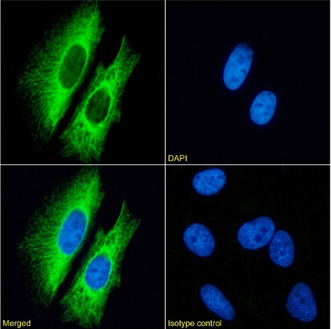 Cytokeratin 7 Chimeric Antibody in Immunocytochemistry (ICC/IF)