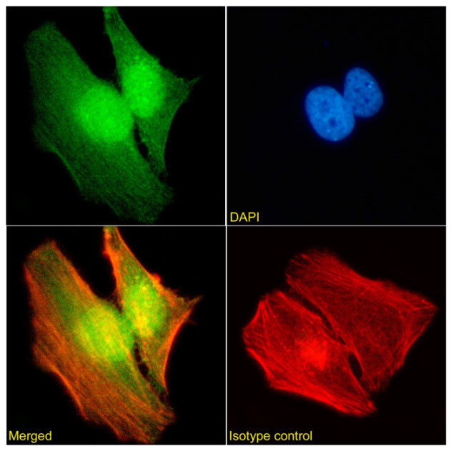 WDR5 Chimeric Antibody in Immunocytochemistry (ICC/IF)