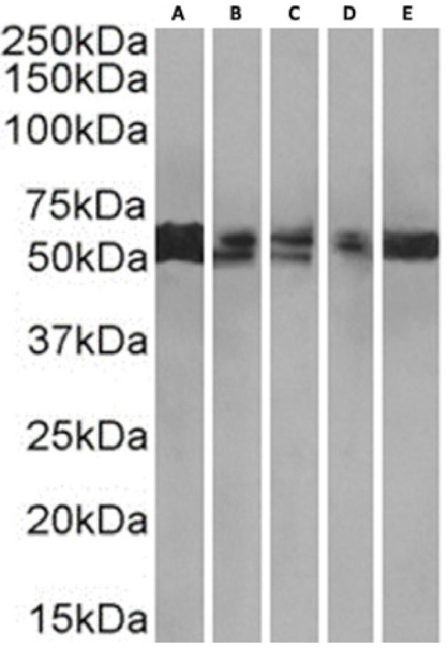 PRMT3 Chimeric Antibody in Western Blot (WB)