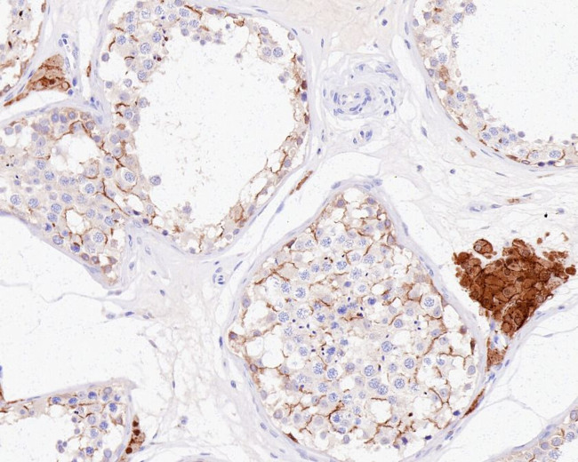 Connexin 43 Antibody in Immunohistochemistry (Paraffin) (IHC (P))