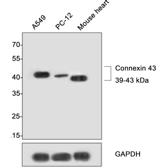 Connexin 43 Antibody in Western Blot (WB)