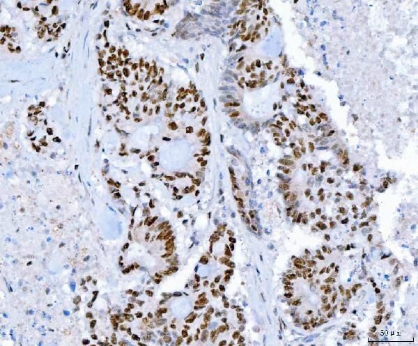 SP1 Antibody in Immunohistochemistry (Paraffin) (IHC (P))