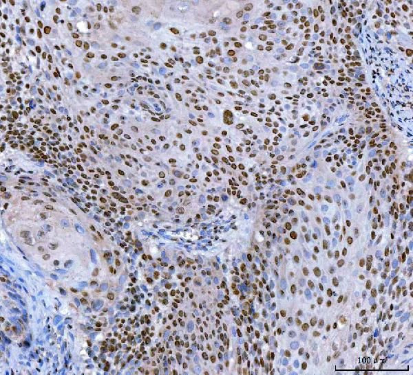 SP1 Antibody in Immunohistochemistry (Paraffin) (IHC (P))