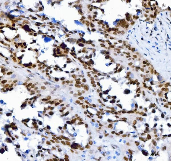 SP1 Antibody in Immunohistochemistry (Paraffin) (IHC (P))