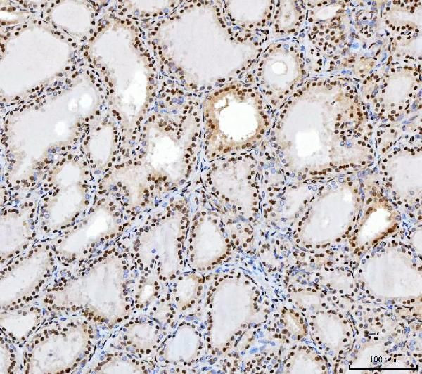 SP1 Antibody in Immunohistochemistry (Paraffin) (IHC (P))