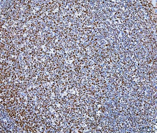 SP1 Antibody in Immunohistochemistry (Paraffin) (IHC (P))