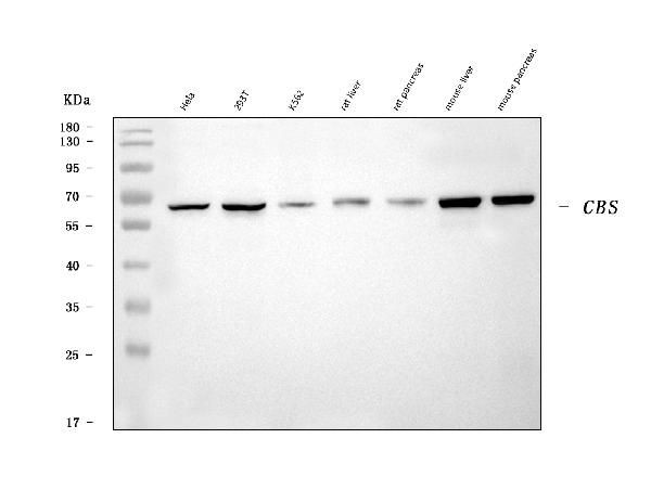 CBS Antibody in Western Blot (WB)