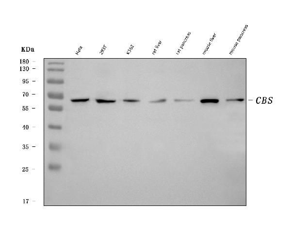 CBS Antibody in Western Blot (WB)