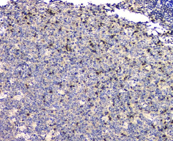 SHP2 Antibody in Immunohistochemistry (Paraffin) (IHC (P))