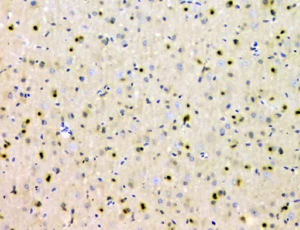 SHP2 Antibody in Immunohistochemistry (Paraffin) (IHC (P))