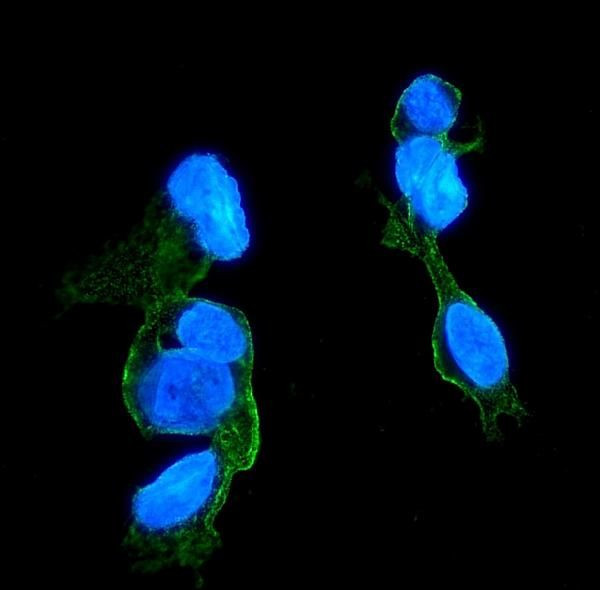 CCR2 Antibody in Immunocytochemistry (ICC/IF)