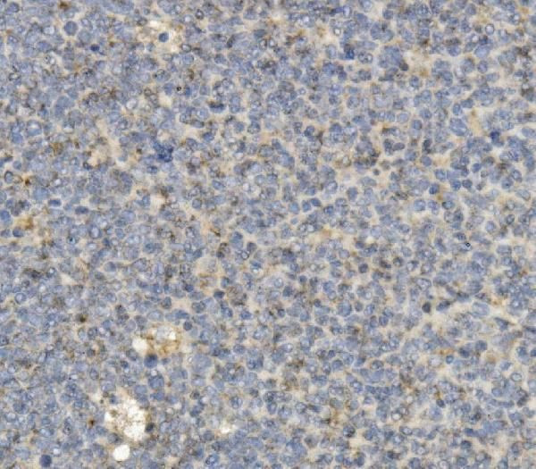 CCR2 Antibody in Immunohistochemistry (Paraffin) (IHC (P))