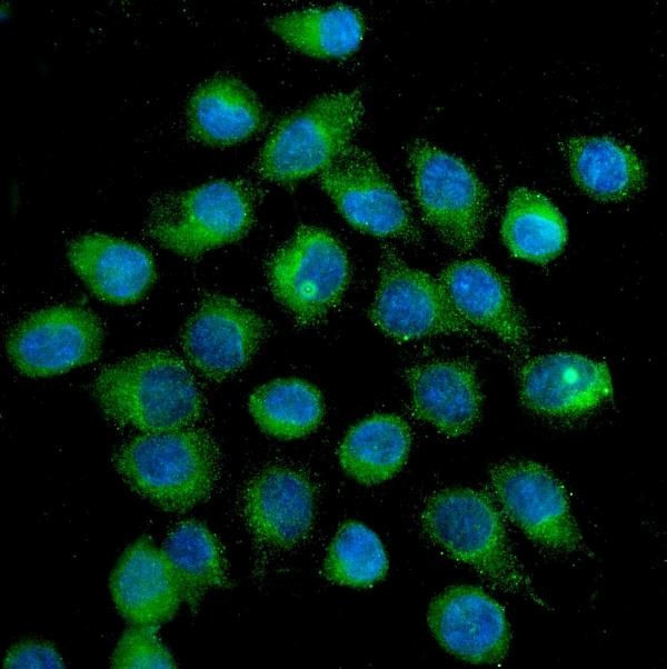 GLUT1 Antibody in Immunocytochemistry (ICC/IF)